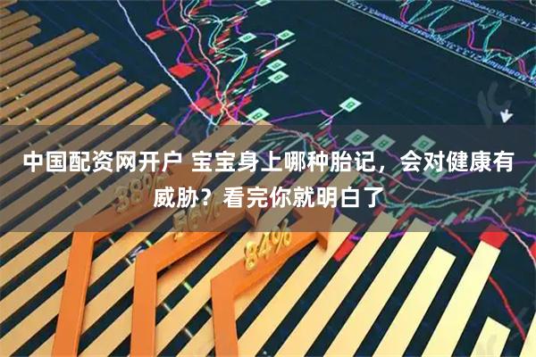 中国配资网开户 宝宝身上哪种胎记，会对健康有威胁？看完你就明白了