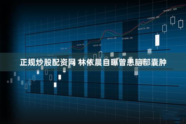 正规炒股配资网 林依晨自曝曾患脑部囊肿